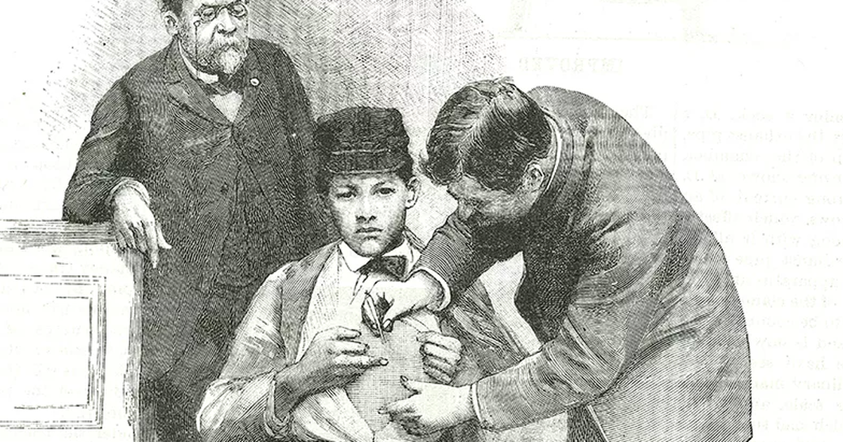 Первая вакцина от бешенства. Луи Пастер вакцина от бешенства. Луи Пастер прививки. Луи Пастер первая вакцинация. 6 Июля 1885 года Луи Пастер.