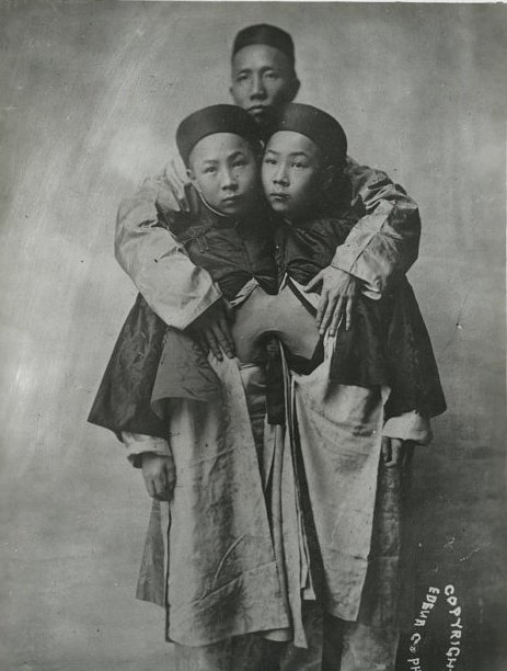 Первые в мире сиамские близнецы, у которых на двоих был 21 ребенок: как они жили и работали